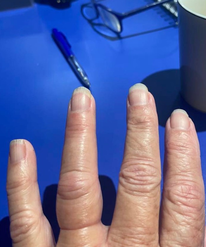 Worst case scenario..